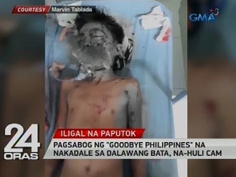 Body wraps para sa pagbaba ng timbang at tiyan lyashek Complex pagsasanay fitness pagbaba ng timbang