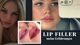 All about my lips- Kosten, Wo, Wie viel ml, Schmerzen