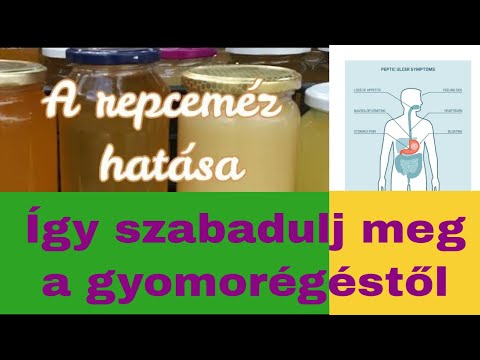 A repceméz hatása - gyomorsav, gyomorégés, reflux ellen