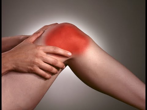 Artroza celei de a doua articulații a genunchiului