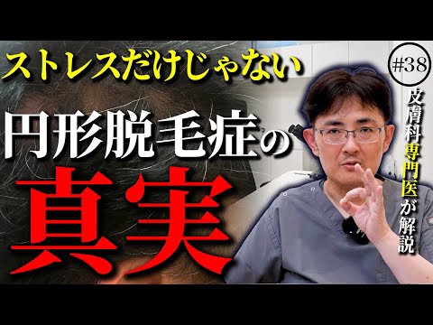 脱毛症について詳しく解説