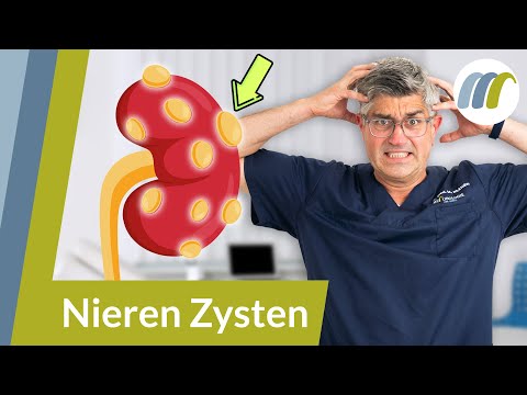 Kidney cyst? These 3 signs determine whether it's harmless or dangerous | Urologie am Ring