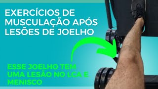 Musculação após Lesao de Menisco e L.C.A. - Ganho de força