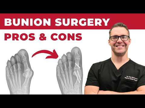 TOP 13 Ways to Shrink Bunions Naturally 1 HUGE SECRET