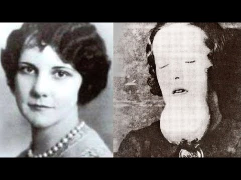 'Это случайность,' - уверяли врачи, но скоро страшная правда потрясла мир.