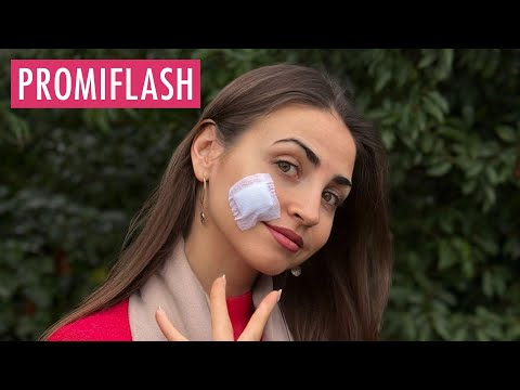 Ekat Leonova musste Muttermal im Gesicht entfernen lassen