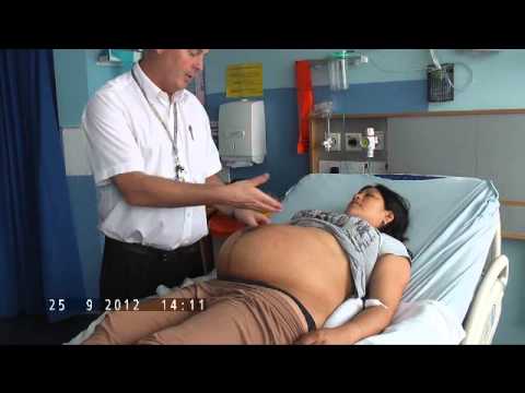 How to Perform Obstetric Palpation for OSCE's