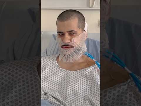 HamedLoco about his broken jaw ????