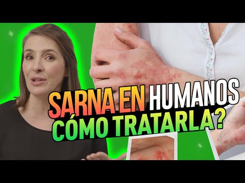 🔴 BE CAREFUL! IF YOU FEEL THIS, YOU MAY HAVE SCABIES OR SCABIES @drapilarochoa - Dermatologist