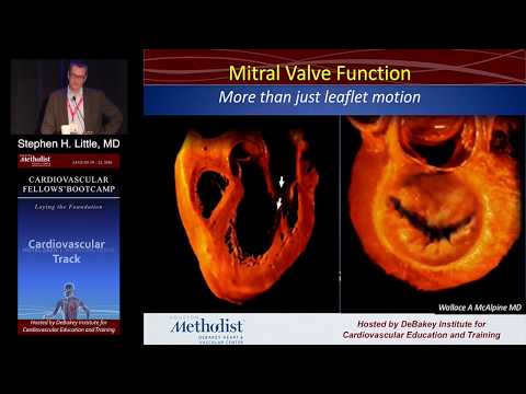 Mitral Stenosis (Stephen H. Little, MD)  Sunday, August 21, 2016