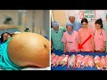 Une mère donne naissance à 10 bébés et les médecins réalisent que l'un d'eux n'est pas un bébé !