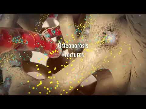 Hyperparathyroidism Explained | Causes, Symptoms & Health Risks #hyperparathyroidism #thyroid