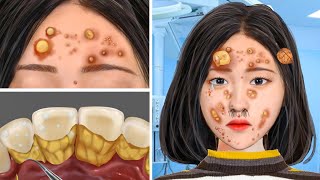 ASMR Facial Pimple Clearing & Tartar Removal | Deep Cleaning Animation
