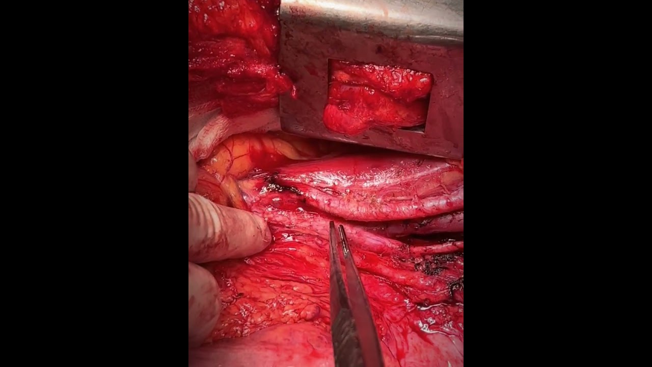 Ángel Millán Juárez-98