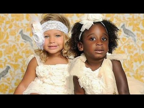 Mom's Twins Born Different Colors. 18 Years Later, This Is What They Look Like