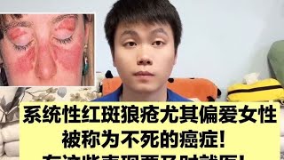 系统性红斑狼疮是个什么病？应该怎么治疗？你想知道的这里都有