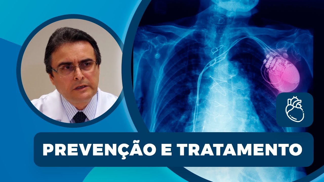 Arritmias cardíacas | Prevenção e tratamento