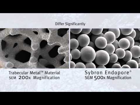 Dental Implant-Khoury-Trabecular Metal