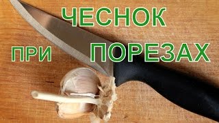 Чем намазать порез или рану, чтобы заживало бысьтро - видео онлайн