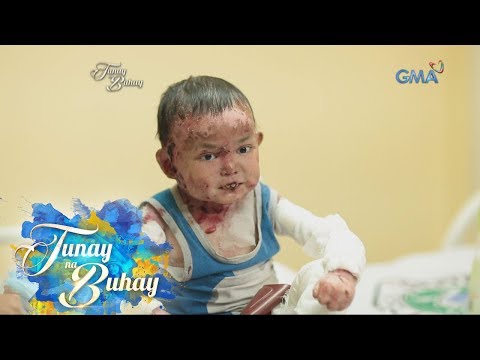 Kaniyang inalis ang mga kuko sa paa na ituturing Trosud paghahanda mula sa mga halamang-singaw