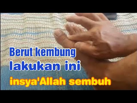 Pijat mengatasi perut kembung