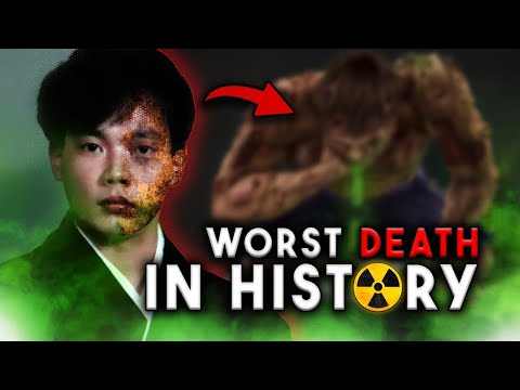 DNA Destroyed in Nanoseconds - Most Radioactive man | Hisashi Ouchi met Nuclear Disaster