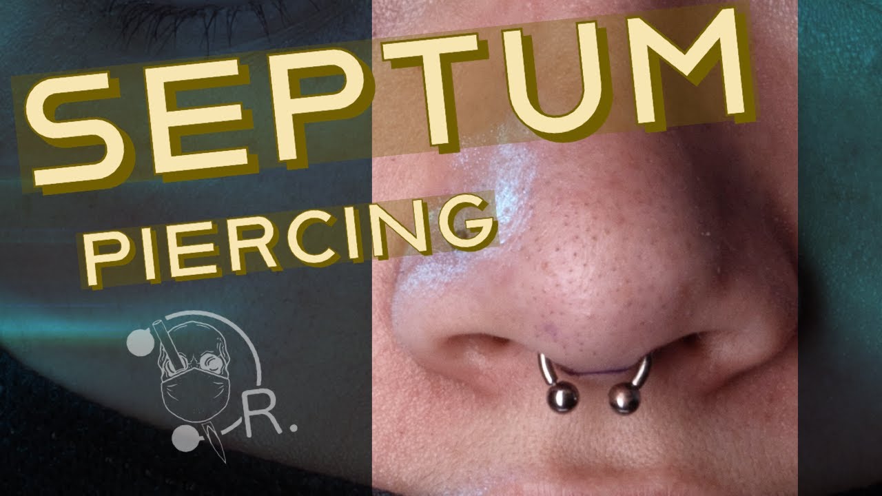 CORRECTING A SEPTUM PIERCING
