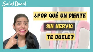 👉🏼¿Por que un diente sin nervio te duele