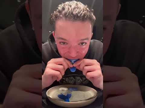 How To Take Perfect Grillz Impressions! A Complete Guide