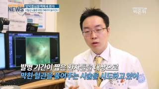 망막중심동맥폐쇄술이란?