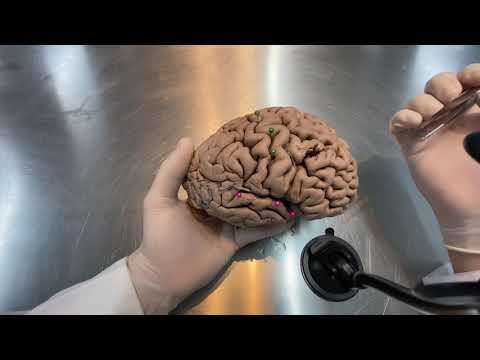 Telencephalon - Delimiting lobes and sulci