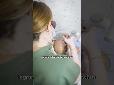 video xchU2fpLwgc