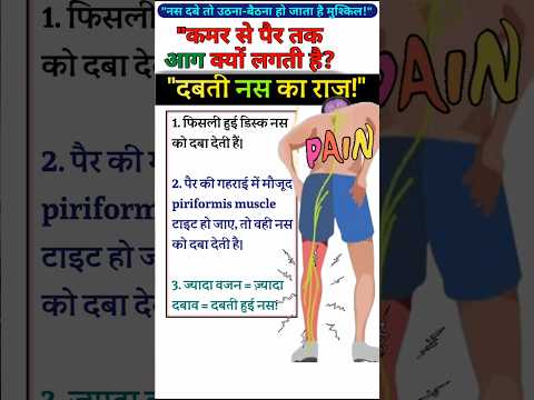"दबती नस का राज!" 😱😭🔥#viralvideo #viralshorts #physiodrdeepaksoni #sciatica