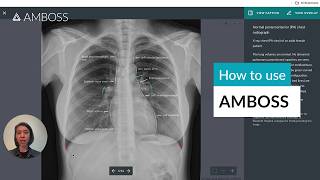 How to use AMBOSS for MD Students: Unlocking Success in In-House Exams and Step 1