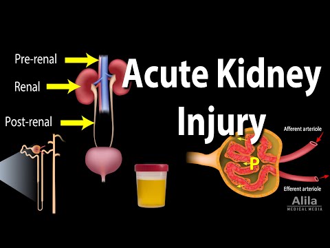 Acute Kidney Injury, a.k.a. Acute Renal Failure, Animation