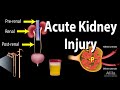 Acute Kidney Injury A K A Acute Renal Failure Animation