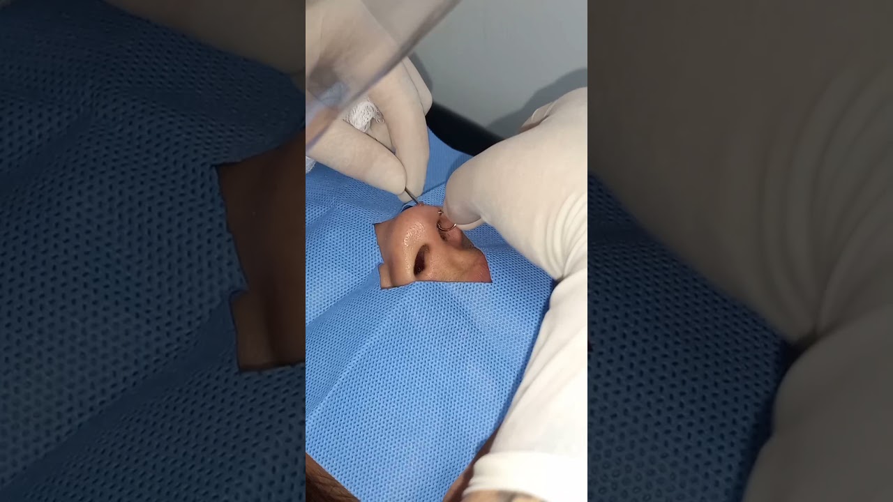 Aplicaçao de D-ring na aba nasal #piercing #tiktok