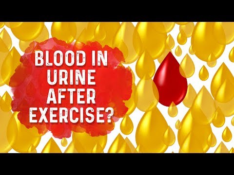 The Top SUPERFOODS for the Kidneys—Explained by Dr Berg