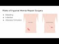Inguinal Hernia Repair Surgery, Risks and Outcomes - CHI Health