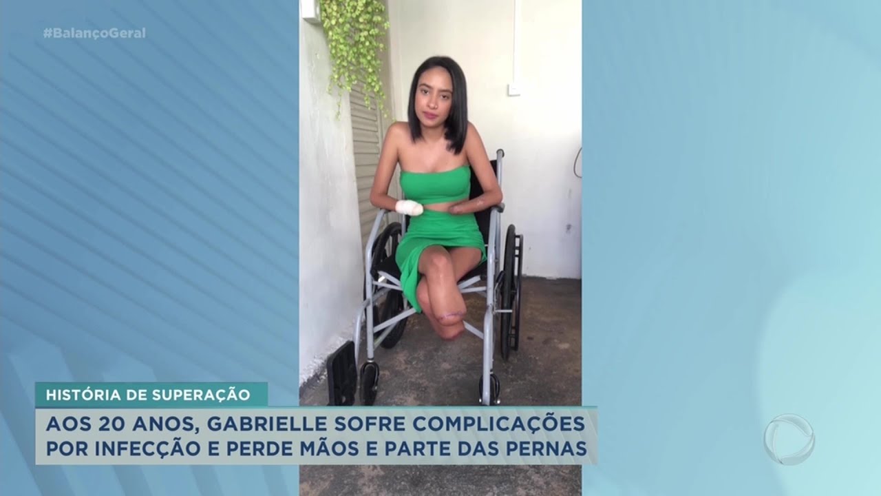 Jovem tem complicações por infecção urinária e perde mãos e parte das pernas, em Franca