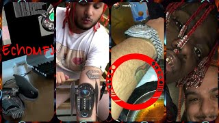 Proof Nessly Did NOT Get AutoTune Implant!