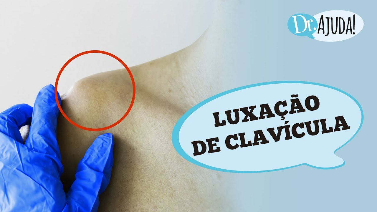 LUXAÇÃO DA CLAVÍCULA: SINTOMAS, DIAGNÓSTICO, CAUSAS E TRATAMENTO