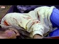 Challenging Case For Police Madan Mohini Movie Scenes