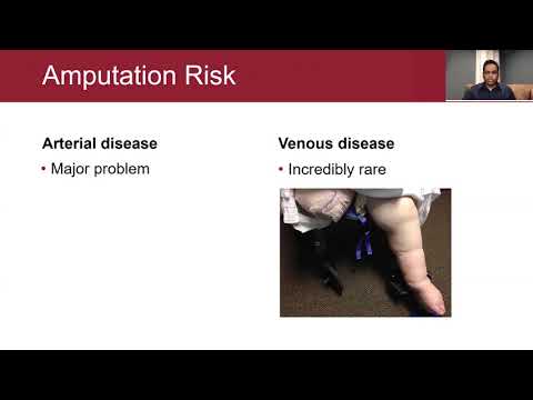 The Evolving Role of Venous Stents and How New Data Will Effect The Clinical Landscape