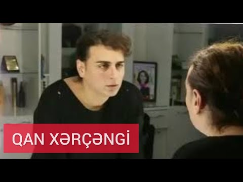 Müğənni Xatunun qardaşı stilist Balaşın ölüm səbəbi məlum.....QAN XƏRÇƏNGİ