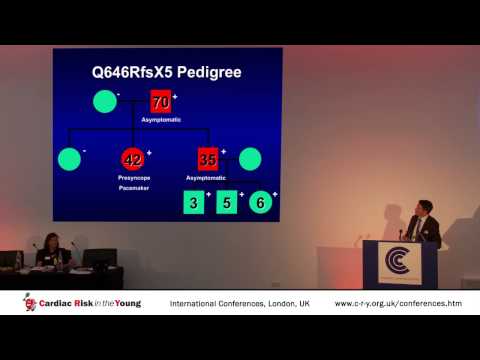 Ion Channelopathies: An Overview of Brugada Syndrome