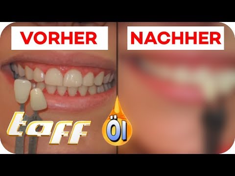 Endlich weiße Zähne - 3 DIY-Beautyprodukte im Test | taff | ProSieben
