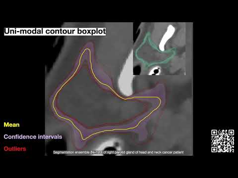 73 FP11 01 Depth for Multi Modal Contour Ensembles