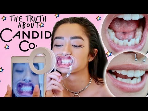 download lagu mp3 mp4 Candid Info, download lagu Candid Info gratis, unduh video klip Candid Info