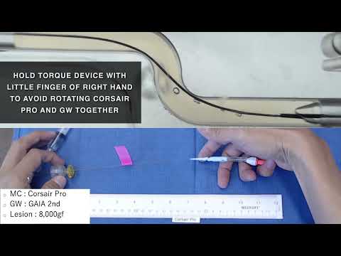 A quick tutorial on advancing your Microcatheter through the lesion.